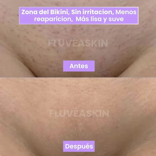 FluvéaSkin® - Vello más fino y menos visible con Raiz de Cyperus Rotundus